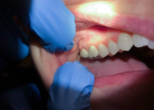 Best Chipped Tooth Repair Near Me  in Tornillo, TX